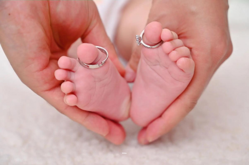 桐乡孕妇怎样预防妊娠纹